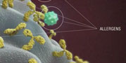 Anaphylaxis management page link